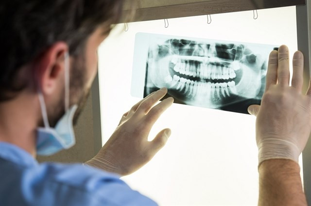 Acromegalia dentista gigantismo