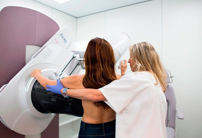 Cáncer de mama mamografía ascires 28052018