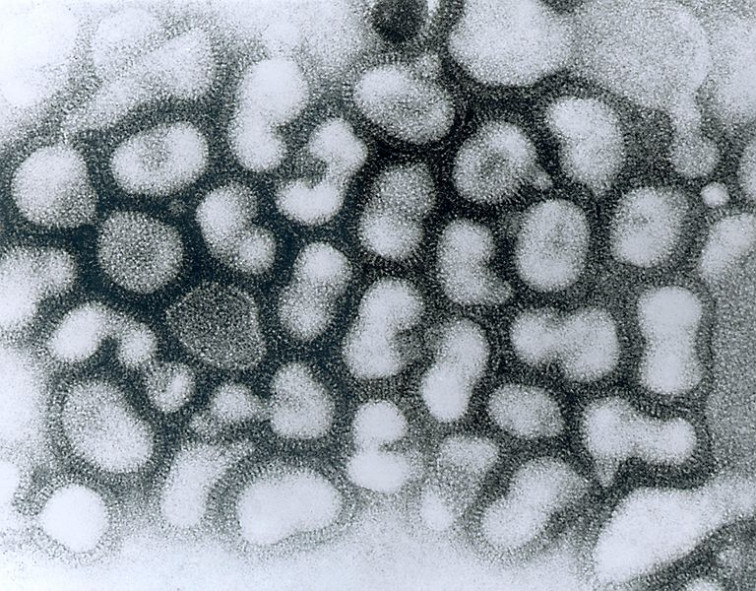 Bulgaria confirma un nuevo brote de gripe aviar en una granja en el norte del país
