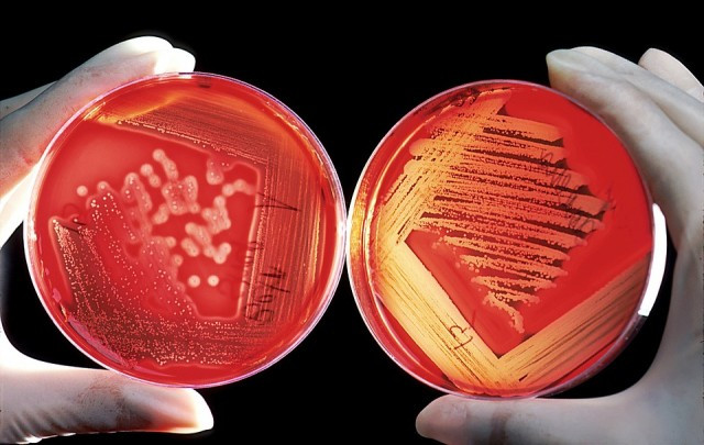 Cultivodebacterias