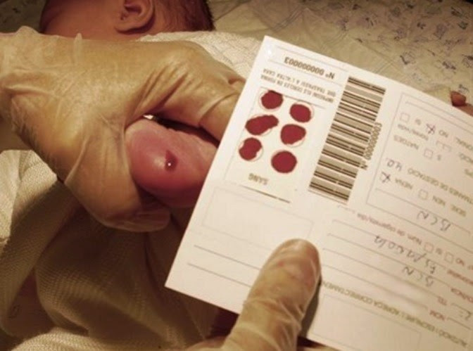 Prueba del talón de cribado neonatal en un bebé