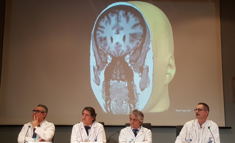El Hospital del Mar estrena una técnica más segura y cómoda para operar lesiones cerebrales