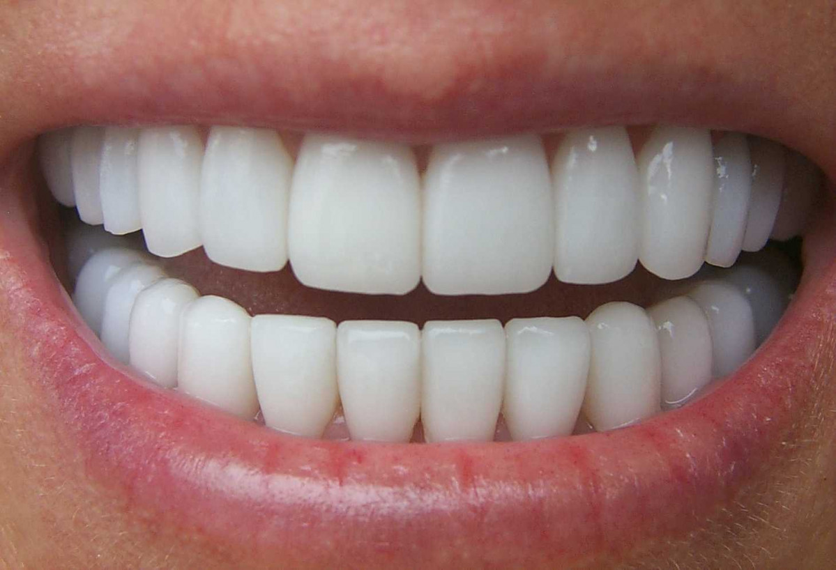 Dentadura imagen