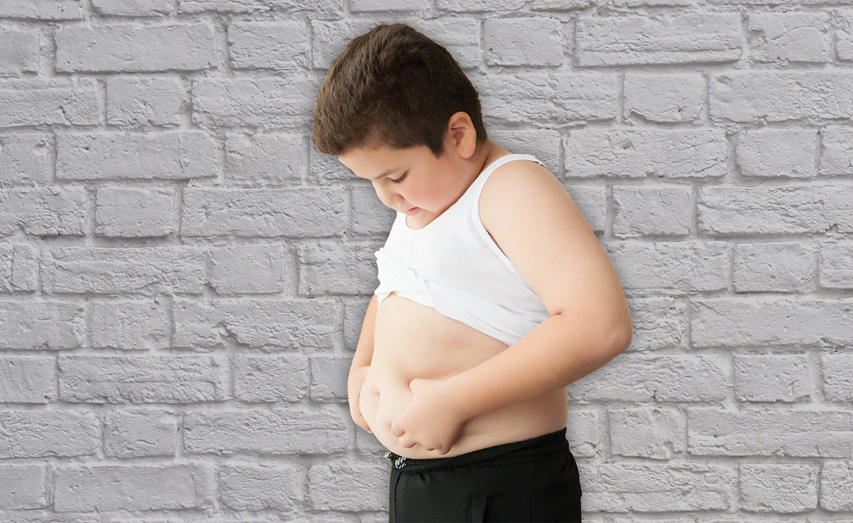 Obesidad infantil imagen