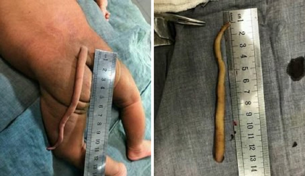 Cola de beb&eacute;2 225x300