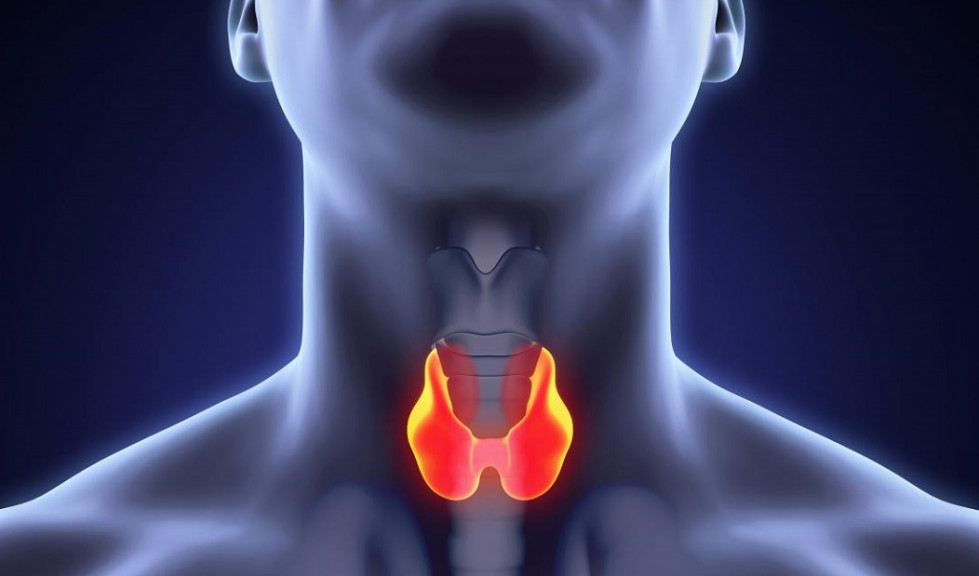 Cáncer de Tiroides