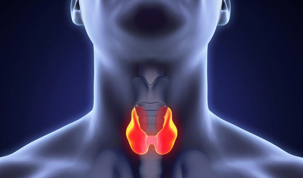Cáncer de Tiroides