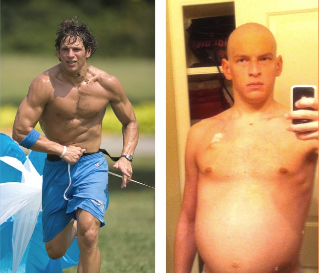 David Fajgenbaum engordu00f3 32 kilos y fue sometido a quimio