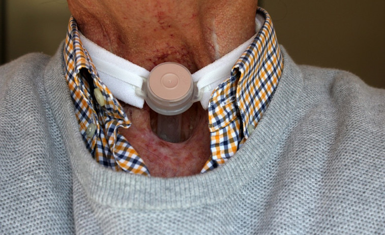 ​Casi la mitad de los tumores de orofaringe pueden estar relacionados con el sexo oral