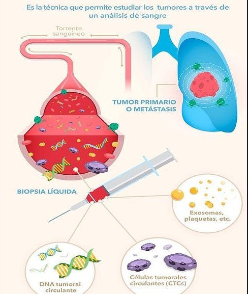 Biopsialiquida