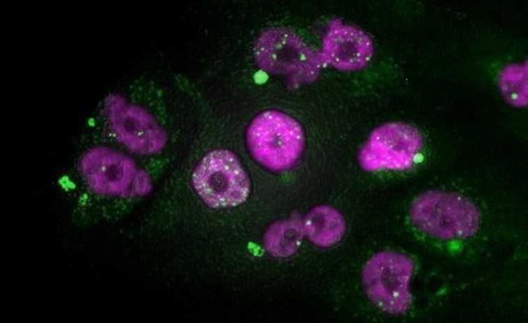 Una estrategia farmacológica impide que los tumores más agresivos generen resistencia a la quimioterapia