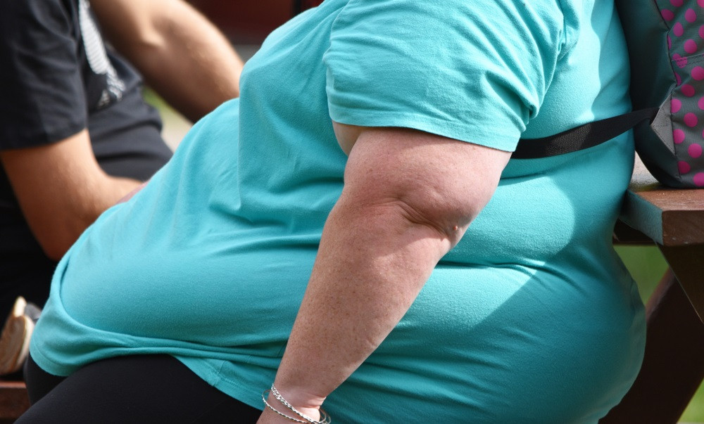 Persona con obesidad