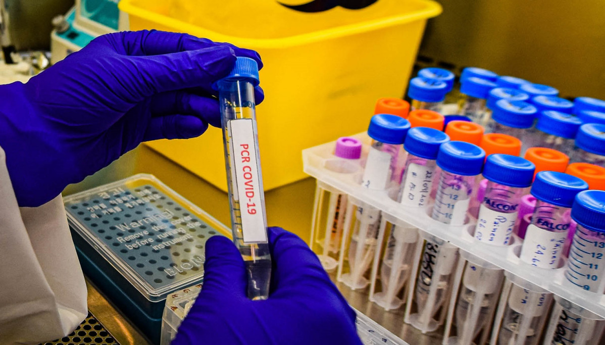 Realización de un test PCR en Chile