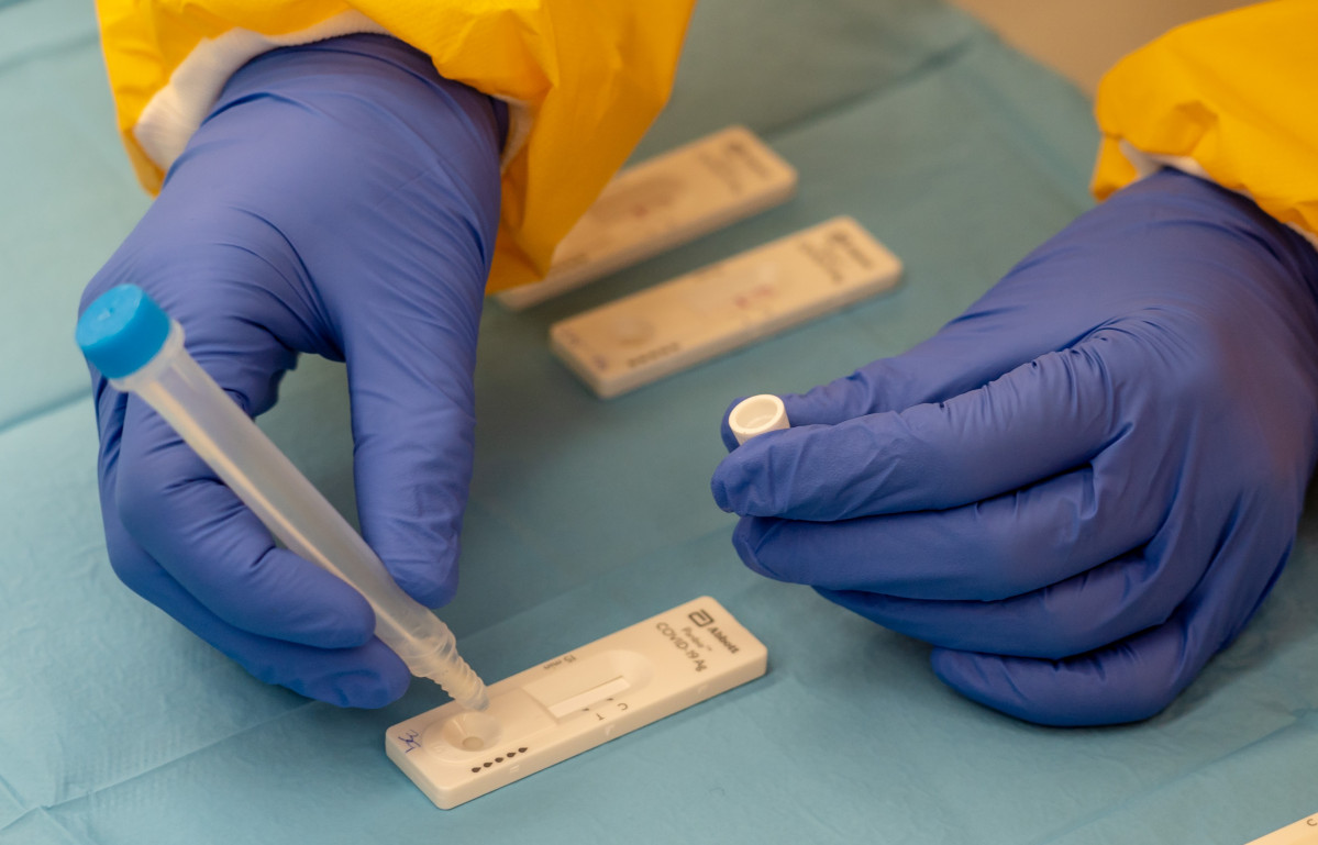 Test diagnóstico de coronavirus (Archivo)