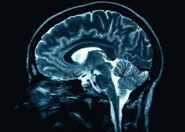 Logran por primera vez llevar fármacos hasta el centro de un tumor cerebral