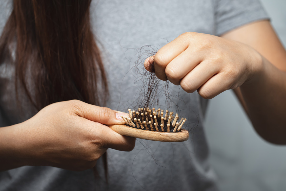 Women have hair loss problems NTHMY4L