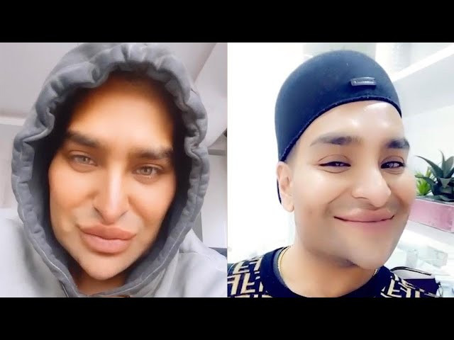 Man Spends Over £130K To Looks Like A Filter
