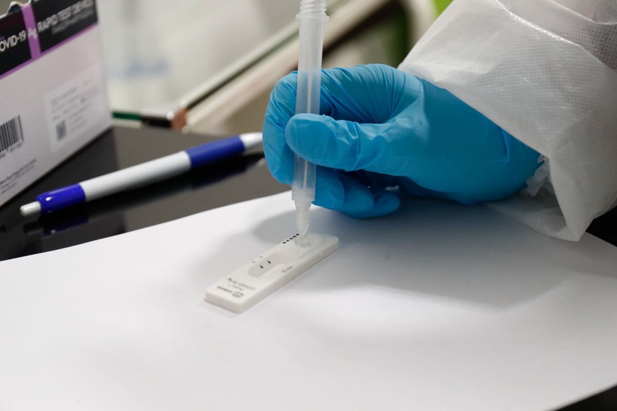 Archivo - Prueba diagnóstica del coronavirus SARS-CoV-2.