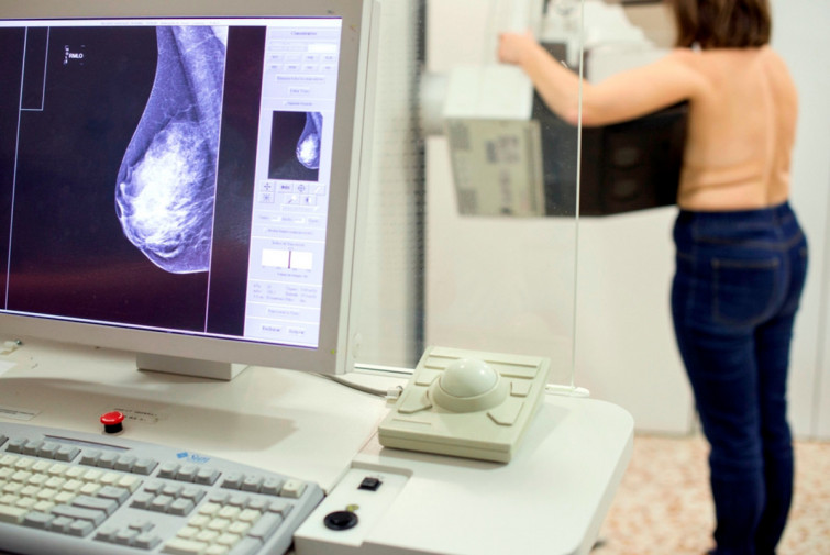 La inmunoterapia sumada a la quimioterapia ayudan a detener el cáncer de mama más agresivo, según un estudio