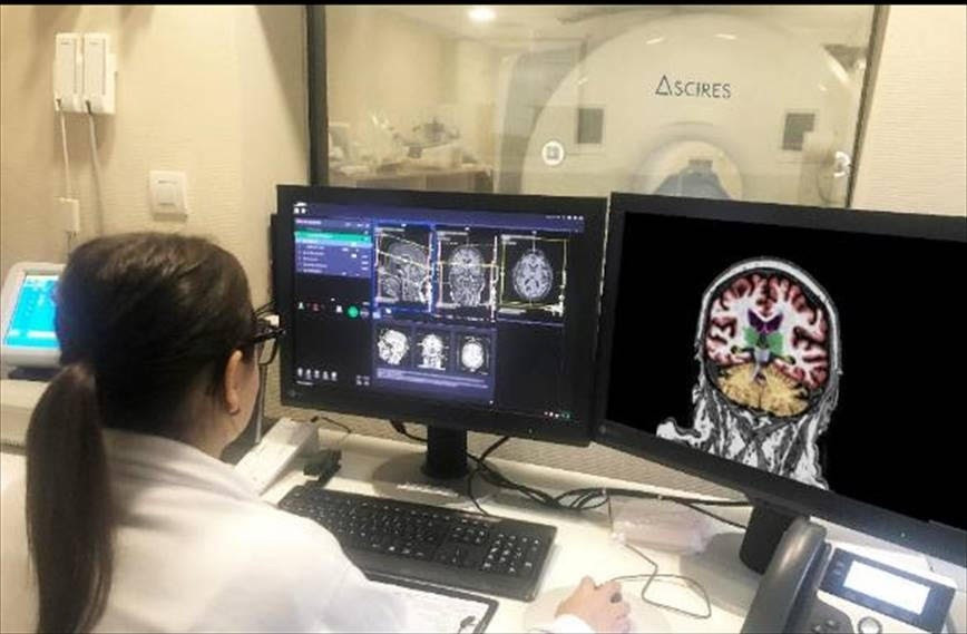 Archivo - La plataforma calcula volúmenes y realiza tractografías cerebrales, para diagnosticar enfermedades como el Alzheimer, la demencia, la epilepsia o la esclerosis múltiple.