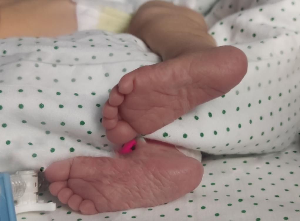 Nace en el Virgen del Rocío un bebé operado de espina bífida durante la gestación en plena pandemia por Covid.