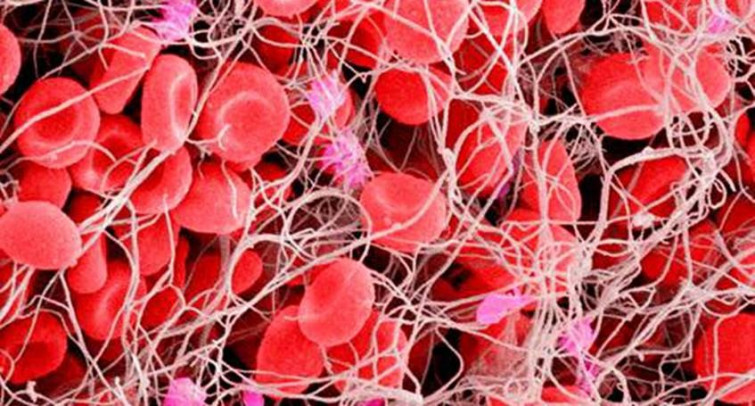 Investigadores del CSIC identifican moléculas que revierten el efecto anticoagulante de la heparina