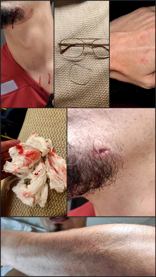 Catalunyapressagressioturista