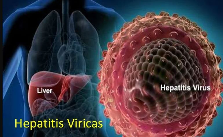 Hepatititis