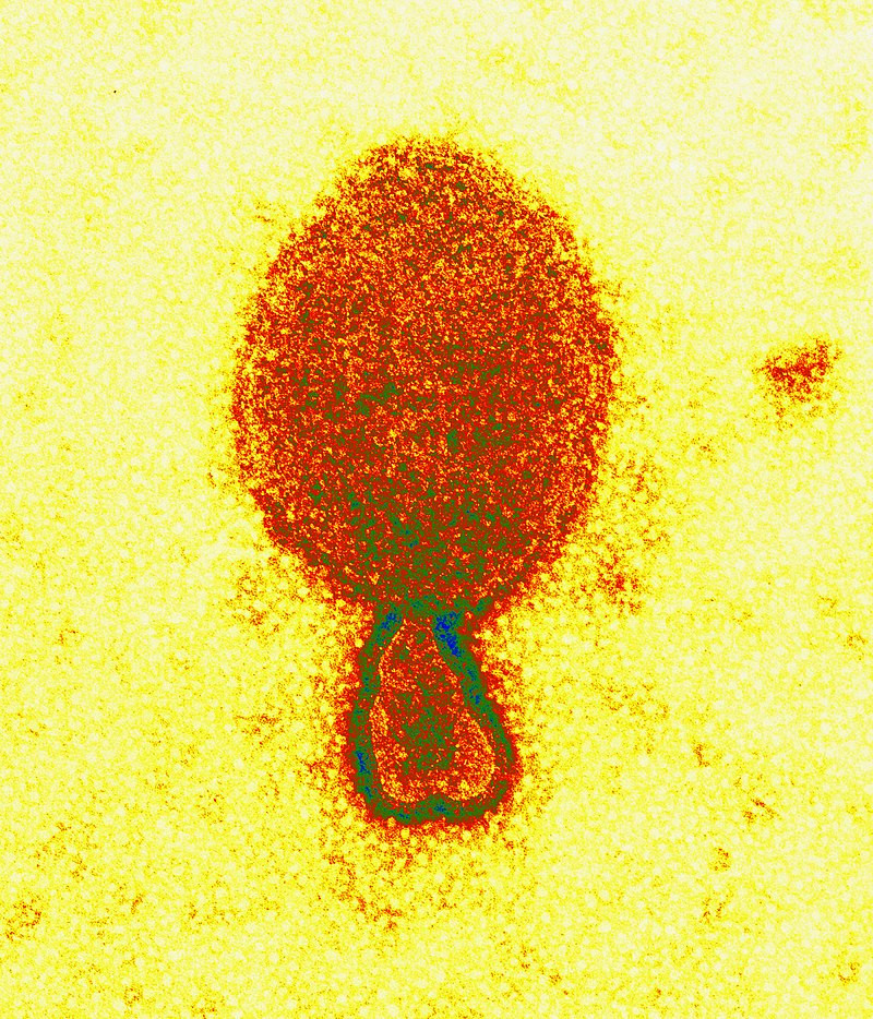 CSIRO ScienceImage 1718 The Hendra Virus