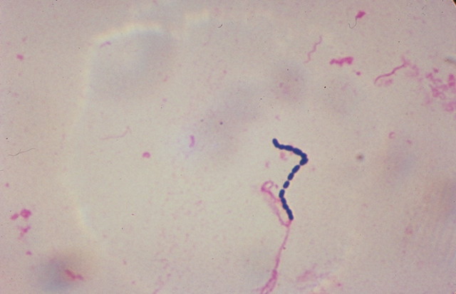 Streptococcus (1)