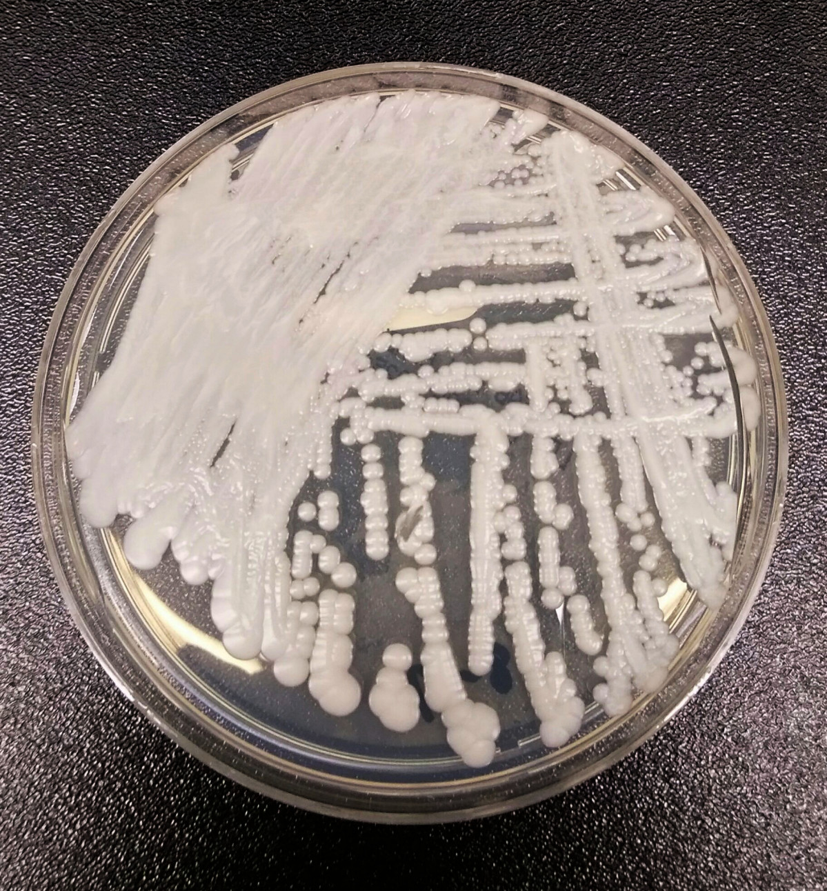Candida auris 2016 250px