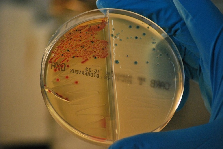 Catalunya press   antibióticos (2)