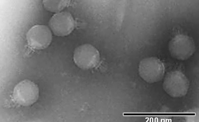 Alarma sanitaria mundial: el virus Nipah registra una letalidad de hasta el 75%