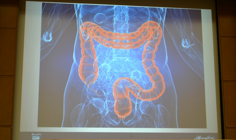 Un nuevo método computacional ayudará a conocer la progresión del cáncer colorrectal