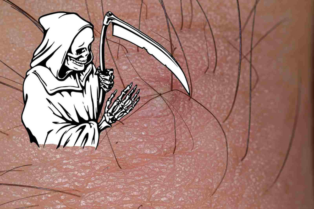 Grano muerte 1600 1067
