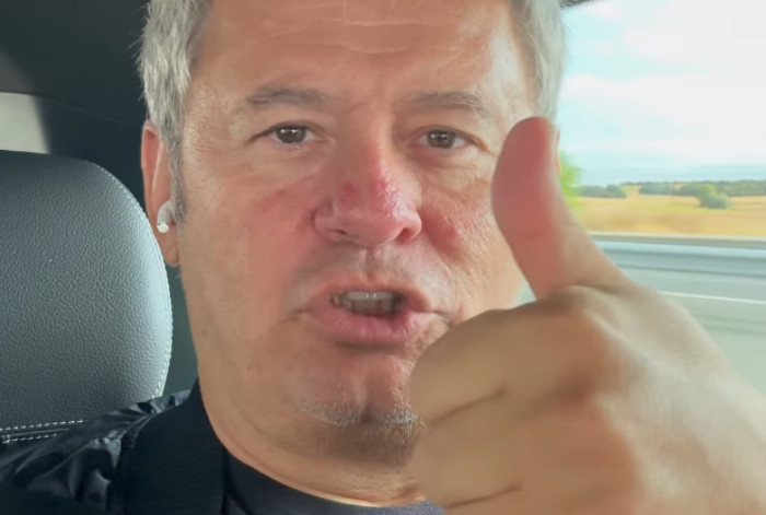 Miki Nadal tranquiliza a sus seguidores tras sufrir un aparatoso accidente de tráfico