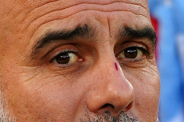 El City de Guardiola cae en Anfield y suma la sexta derrota en siete partidos (2-0)