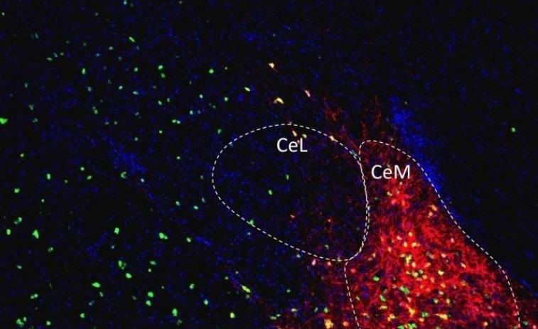 Extirpar las amígdalas no está relacionado con un aumento de peso indeseable, contrariamente a la creencia común