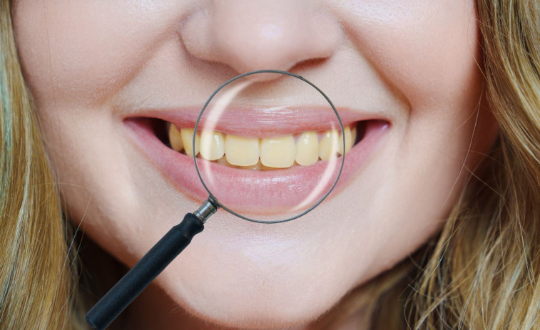 Manchas en los dientes: las causas principales y cómo prevenirlas