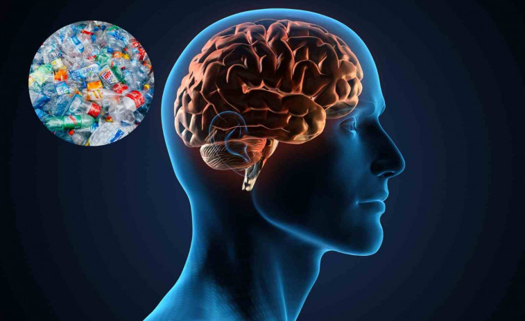 La presencia de microplásticos en el cerebro humano se dispara un 50% en los últimos 8 años