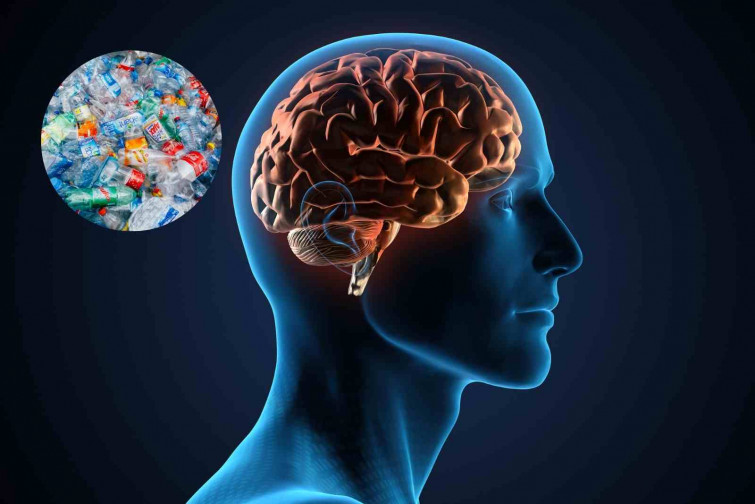 La presencia de microplásticos en el cerebro humano se dispara un 50% en los últimos 8 años