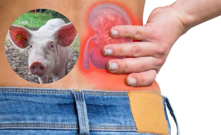 Estados Unidos aprueba ensayos clínicos para trasplantes de riñón de cerdo en humanos