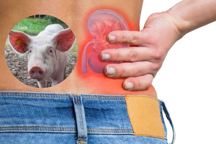 Estados Unidos aprueba ensayos clínicos para trasplantes de riñón de cerdo en humanos