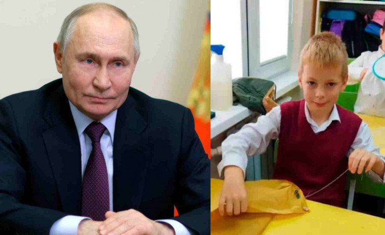 Una manada de perros le arranca la cara a un niño y Putin interviene 