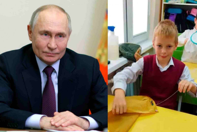 Una manada de perros le arranca la cara a un niño y Putin interviene 