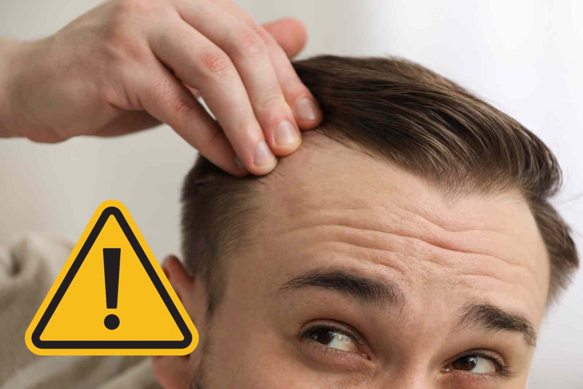 Pelo, alerta