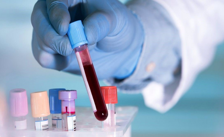 Esperanza para el Alzheimer: un análisis de sangre permite detectar la enfermedad de forma precoz