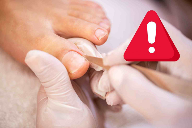 Mírate las uñas de los pies: esta señal podría avisarte de un cáncer