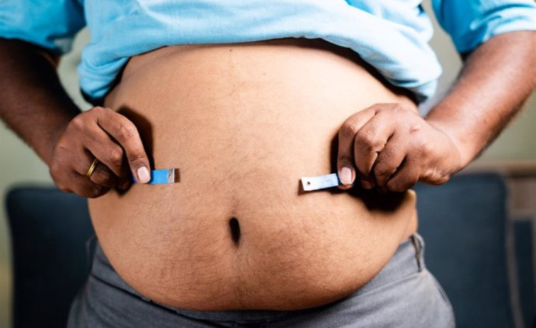 Otro riesgo de la obesidad grave: esto es lo que ha descubierto una investigación de científicos catalanes