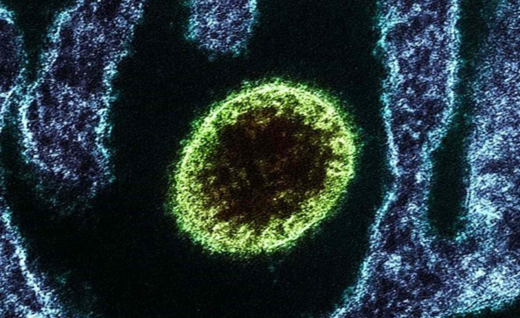 Alarma mundial: Muere una joven por el virus Nipah y crecen los temores de una nueva pandemia